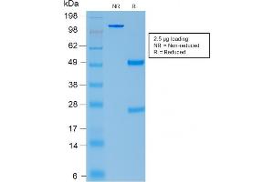 SDS-PAGE Analysis Purified ACTH Rabbit Recombinant Monoclonal Antibody (CLIP/2040R). (Recombinant POMC antibody  (AA 1-24))