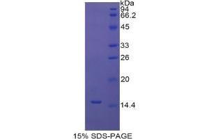 SDS-PAGE analysis of Rat UCP1 Protein. (UCP1 Protein)