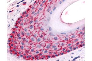 Anti-FAP antibody IHC of human skin, hair follicle. (FAP antibody  (Extracellular Domain))