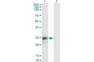 Western Blot analysis of NAAA expression in transfected 293T cell line by NAAA monoclonal antibody (M02), clone 3F4. (NAAA antibody  (AA 36-104))