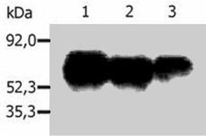 Immunoprecipitation of human PAG1 from the lysate of Raji human Burkitt lymphoma cell line. (PAG1 antibody  (C-Term))