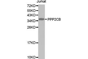 Western blot analysis of extracts of Jurkat cell lines, using PPP2CB antibody. (PPP2CB antibody  (AA 1-309))