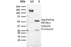 SDS-PAGE Analysis Purified CD3e Rabbit Recombinant Monoclonal Antibody (C3e/3125R). (Recombinant CD3 epsilon antibody  (AA 23-119))