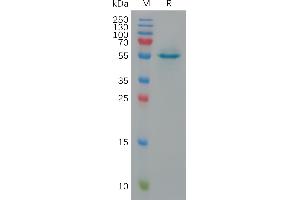 Human CALR Protein, His Tag on SDS-PAGE under reducing condition. (Calreticulin Protein (CALR) (AA 18-417) (His tag))