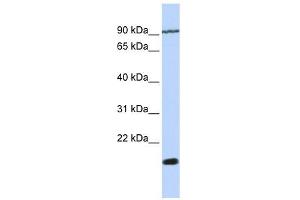 TM4SF4 antibody used at 1 ug/ml to detect target protein. (TM4SF4 antibody  (N-Term))