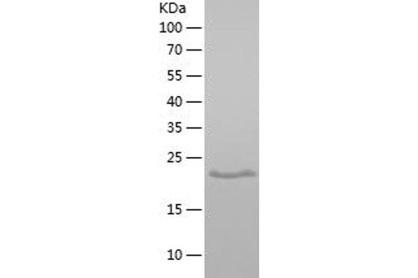 Proline Rich 13 Protein (PRR13) (AA 1-148) (His tag)