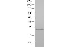 Western Blotting (WB) image for Proline Rich 13 (PRR13) (AA 1-148) protein (His tag) (ABIN7124592) (Proline Rich 13 Protein (PRR13) (AA 1-148) (His tag))