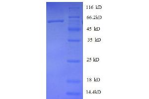 SDS-PAGE (SDS) image for Heterogeneous Nuclear Ribonucleoprotein D (HNRNPD) (AA 18-355), (partial) protein (GST tag) (ABIN1047165) (HNRNPD/AUF1 Protein (AA 18-355, partial) (GST tag))