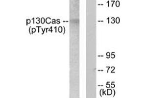 Western blot analysis of extracts from NIH-3T3 cells, using p130 Cas (Phospho-Tyr410) Antibody. (BCAR1 antibody  (pTyr410))