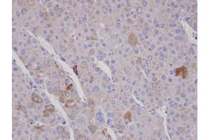 IHC-P Image Immunohistochemical analysis of paraffin-embedded human adrenal gland tumor, using FBXO2, antibody at 1:100 dilution. (FBXO2 antibody  (C-Term))