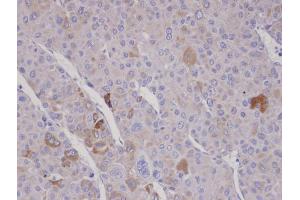 IHC-P Image Immunohistochemical analysis of paraffin-embedded human adrenal gland tumor, using FBXO2, antibody at 1:100 dilution. (FBXO2 antibody  (C-Term))