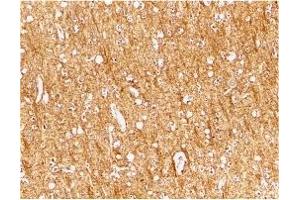 Immunohistochemistry (IHC) image for anti-ATR serine/threonine kinase (ATR) (Middle Region) antibody (ABIN1030871) (ATR antibody  (Middle Region))