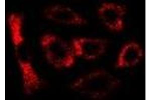 Immunofluorescent analysis of LC3B staining in U2OS cells. (LC3B antibody)