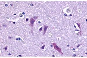 QRFPR antibody  (Cytoplasmic Domain)