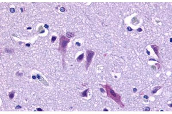 QRFPR antibody  (Cytoplasmic Domain)
