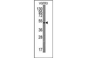 Western Blotting (WB) image for anti-Fms-Related Tyrosine Kinase 4 (FLT4) antibody (ABIN356407)