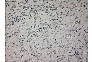 Image no. 1 for anti-Glial Fibrillary Acidic Protein (GFAP) antibody (ABIN1498435) (GFAP antibody)