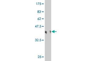 Western Blot detection against Immunogen (36. (CENPP antibody  (AA 1-98))