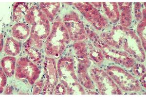 Human Kidney: Formalin-Fixed, Paraffin-Embedded (FFPE) (Claudin 2 antibody  (AA 135-164))