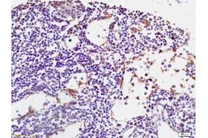 Immunohistochemistry (Paraffin-embedded Sections) (IHC (p)) image for anti-Tumor Necrosis Factor Receptor Superfamily, Member 11a, NFKB Activator (TNFRSF11A) (AA 51-150) antibody (ABIN749258)