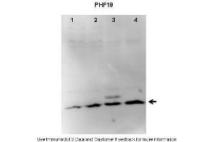 Lanes:   1. (PHF19 antibody  (C-Term))