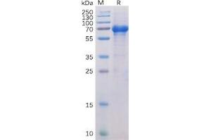 Human OX40 Protein, hFc-His Tag on SDS-PAGE under reducing condition. (TNFRSF4 Protein (Fc-His Tag))