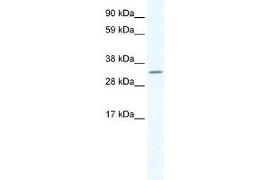 WB Suggested Anti-APEX1 Antibody Titration:  1. (APEX1 antibody  (N-Term))