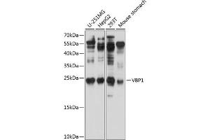 Western blot analysis of extracts of various cell lines, using VBP1 antibody (ABIN6129700, ABIN6150068, ABIN6150069 and ABIN6224846) at 1:1000 dilution. (VBP1 antibody  (AA 1-197))