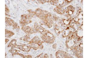 IHC-P Image Immunohistochemical analysis of paraffin-embedded Cal27 xenograft, using Kinesin 5A, antibody at 1:100 dilution.