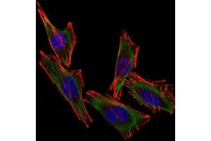 Confocal Immunofluorescent analysis of A2058 cells using CF488-labeled S100B Monoclonal Antibody (S100B/1012) (Green). (S100B antibody  (CF®488A))
