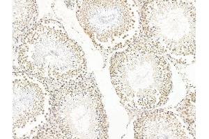 anti-Spectrin Repeat Containing, Nuclear Envelope 1 (SYNE1) (C-Term) antibody