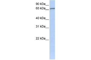 WB Suggested Anti-ZNF41 Antibody Titration:  0. (ZNF41 antibody  (C-Term))