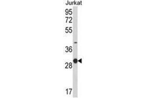 Western blot analysis of KLRC1 Antibody (C-term) in Jurkat cell line lysates (35ug/lane).