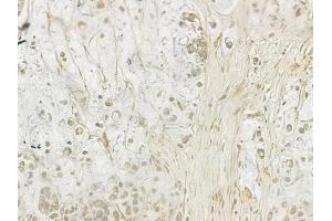 ABIN6257393 and ABIN6274181 at 1/100 staining human normal liver tissue by IHC-P.