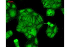 Immunocytochemistry/Immunofluorescence analysis using Rabbit Anti-Rab4 Polyclonal Antibody .