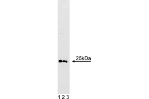 Western Blotting (WB) image for anti-RAB5A, Member RAS Oncogene Family (RAB5A) (AA 1-215) antibody (ABIN967882) (RAB5 antibody  (AA 1-215))