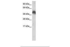 Image no. 1 for anti-Zinc Finger and BTB Domain Containing 43 (ZBTB43) (AA 188-237) antibody (ABIN6736063)