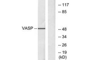 Western blot analysis of extracts from NIH-3T3 cells, treated with forskolin 40myM 30', using VASP (Ab-157) Antibody. (VASP antibody  (AA 124-173))