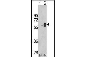Western blot analysis of ARSB (arrow) using rabbit polyclonal ARSB Antibody (Center) (ABIN652346 and ABIN2841582). (Arylsulfatase B antibody  (AA 235-266))