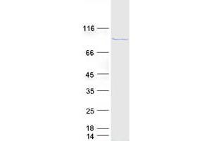 Validation with Western Blot (DDX21 Protein (Myc-DYKDDDDK Tag))