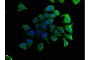 Immunofluorescence staining of A549 cells with ABIN7153457 at 1:50, counter-stained with DAPI. (GAL4 antibody  (AA 1-323))