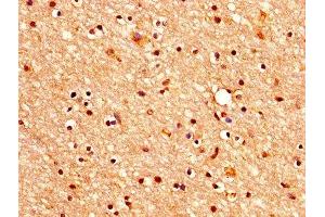 IHC image of ABIN7160347 diluted at 1:400 and staining in paraffin-embedded human brain tissue performed on a Leica BondTM system. (CHRM3 antibody  (AA 253-492))