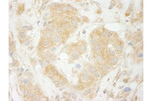 anti-SEC23 Interacting Protein (SEC23IP) (AA 350-400) antibody