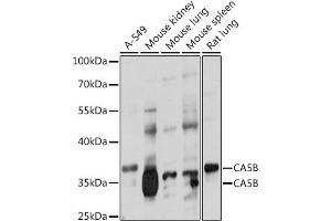Western blot analysis of extracts of various cell lines, using CB antibody (ABIN7266072) at 1:1000 dilution. (CA5B antibody  (AA 1-317))