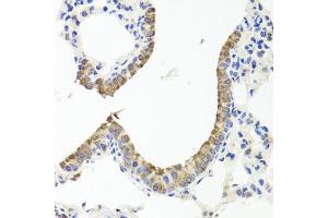 Immunohistochemistry of paraffin-embedded mouse lung using TTR antibody (ABIN3021473, ABIN3021474, ABIN3021475 and ABIN6215107) at dilution of 1:100 (40x lens). (TTR antibody  (AA 21-147))