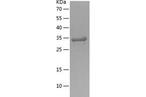 APPL2 Protein (AA 403-664) (His tag)