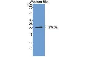 Detection of Recombinant CRYbB2, Rat using Monoclonal Antibody to Crystallin Beta B2 (CRYbB2) (CRYbB2 antibody  (AA 17-191))