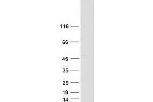 Validation with Western Blot (VPS36 Protein (Myc-DYKDDDDK Tag))