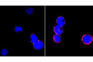 Confocal immunofluorescence analysis of BCBL-1 cells (left) and L1210 cells (right) using CD18 mouse mAb (red). (Integrin beta 2 antibody)