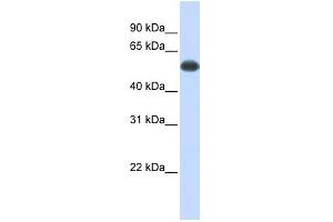 PPP3CA antibody used at 1 ug/ml to detect target protein. (PPP3CA antibody)